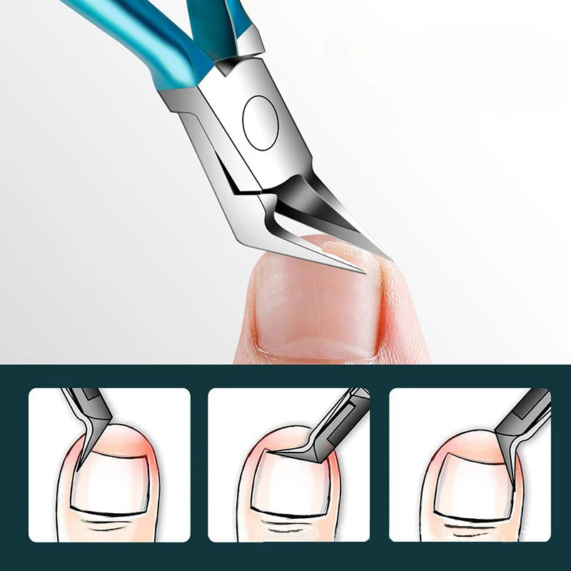 CowLost | toe-nail-clipper-for-ingrown-or-thick-toenails-trimmer-professional |5
