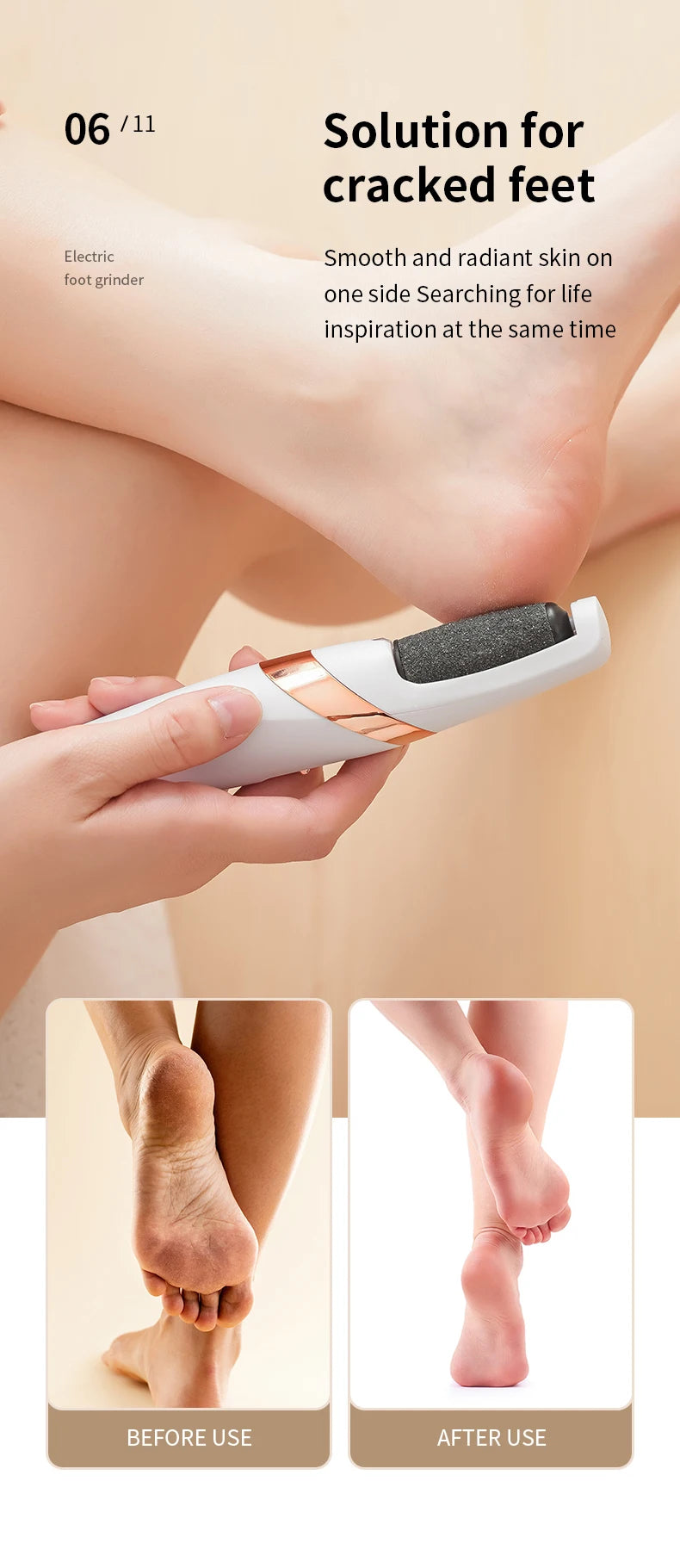 CowLost | product_id-homefish-rechargeable-electric-foot-callus-remover-pedicure-grinder |13