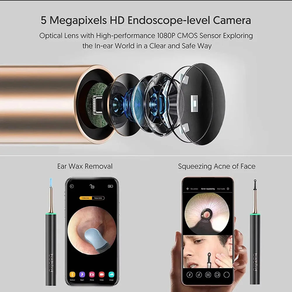 CowLost | product_id-visual-ear-cleaner-5mp-hd-endoscope-camera-blackhead-acne-needle-3-5mm-for-iphone-android |4