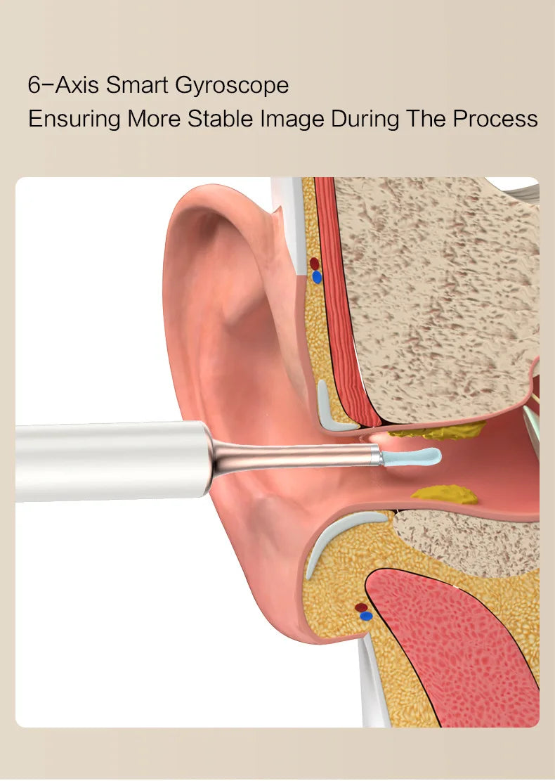 CowLost | product_id-visual-ear-cleaner-5mp-hd-endoscope-camera-blackhead-acne-needle-3-5mm-for-iphone-android |9