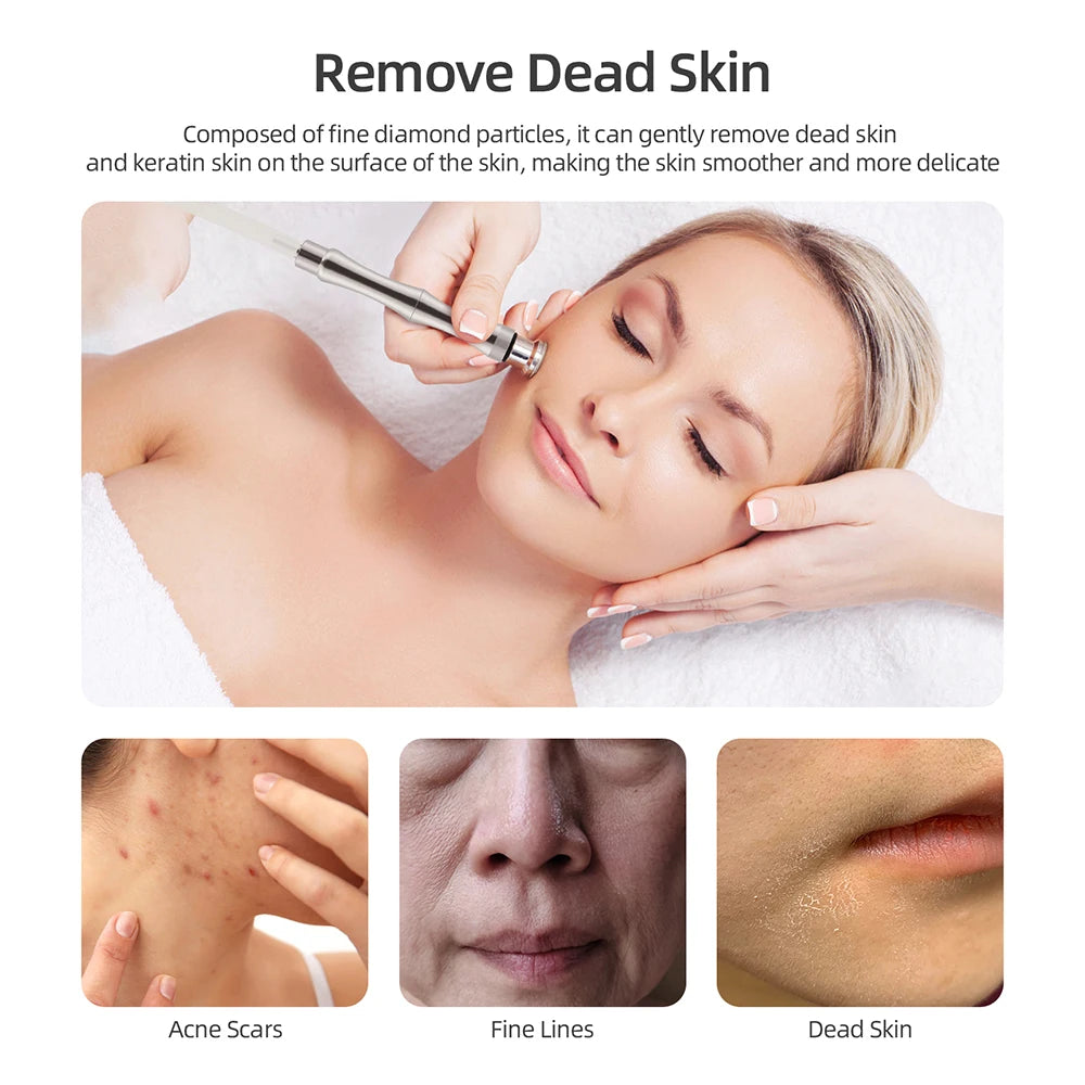 CowLost | vehicle-parts-accessories-diamond-microdermabrasion-machine-professional-skin-care-device |12