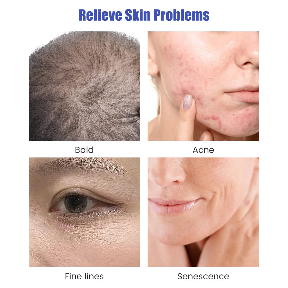 1/10pcs Derma Roller Stamp