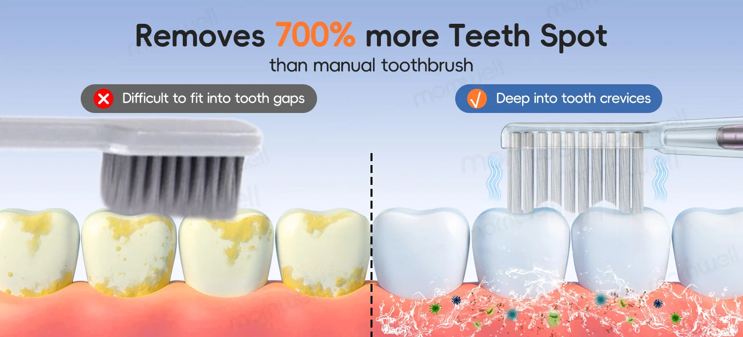 CowLost | uncategorized-mornwell-electric-toothbrush-soft-thin-brush-for-women-rechargeable |8