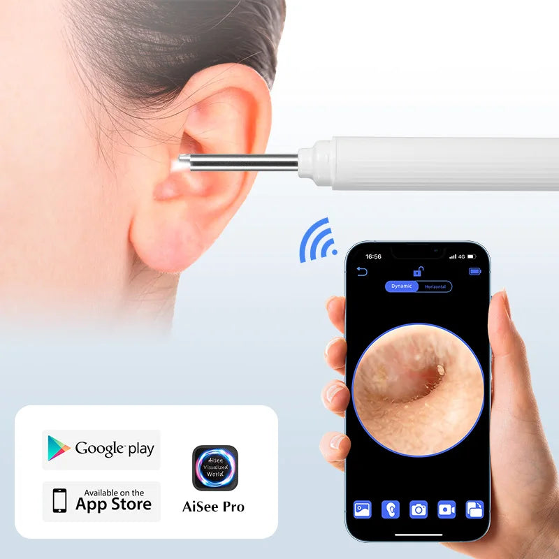 CowLost | 3d-printer-accessories-kerui-5mp-wireless-visual-ear-otoscope-endoscope-earwax-removal-tool |10
