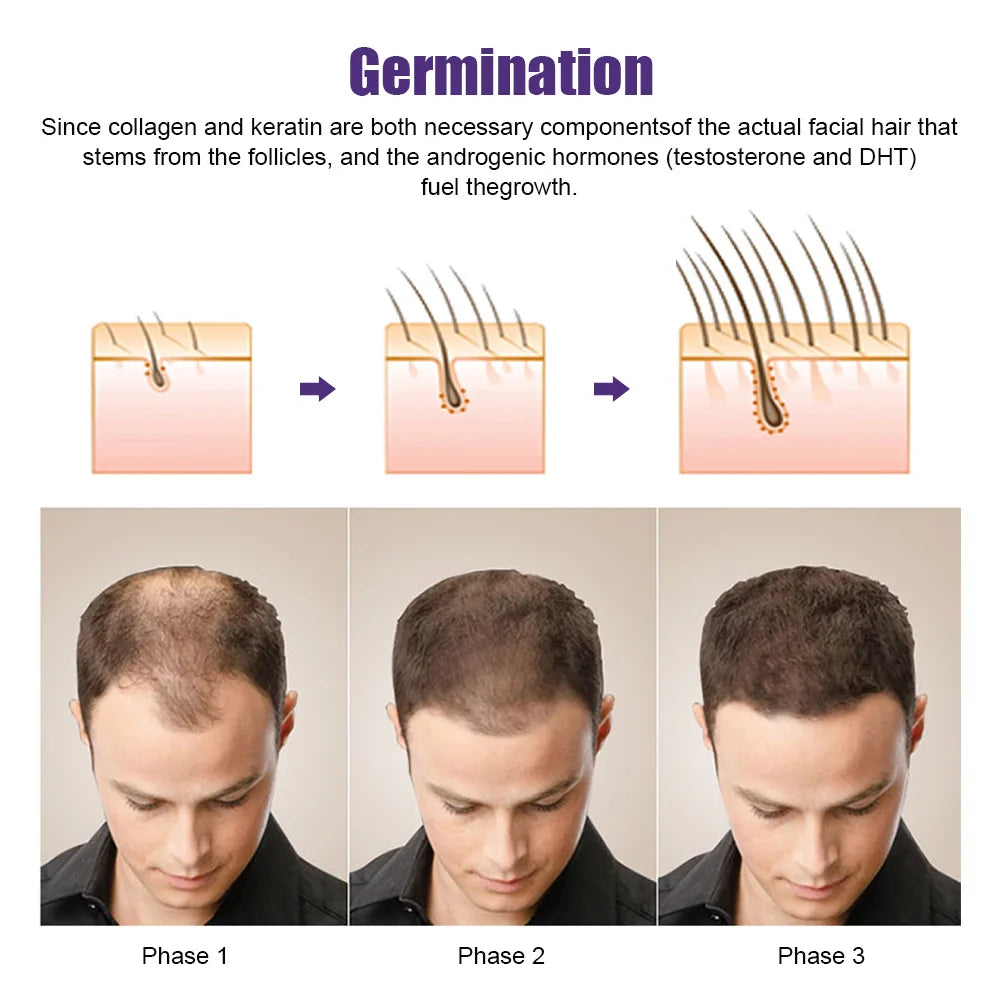 CowLost | vehicle-parts-accessories-suolaer-derma-microneedling-face-roller-for-hair-growth-and-skin-care |4