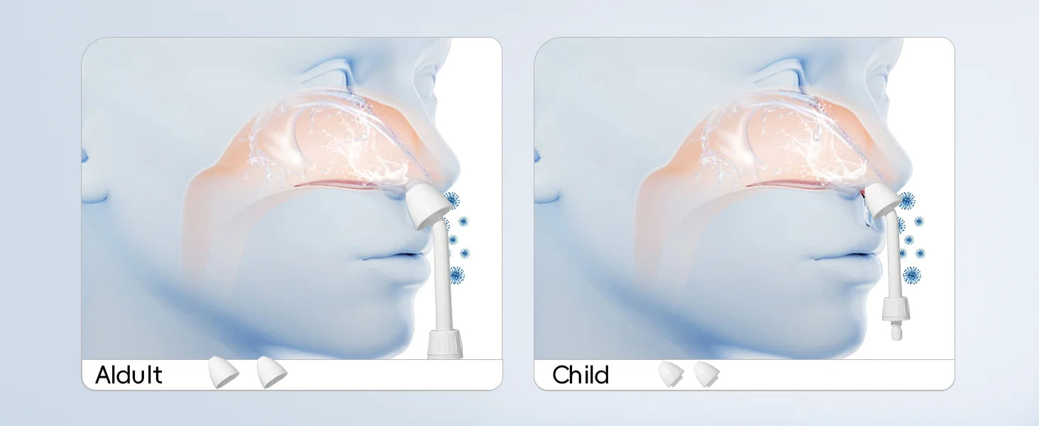 CowLost | uncategorized-mornwell-nasal-rinse-bottle-300ml-electric-sinus-cleaner-with-3-modes-and-2-nozzles |13