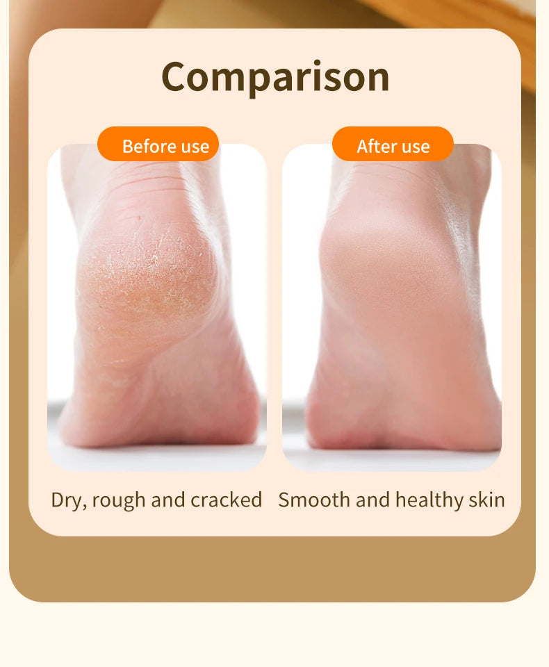 CowLost | product_id-homefish-electric-foot-callus-remover-and-pedicure-grinder |33