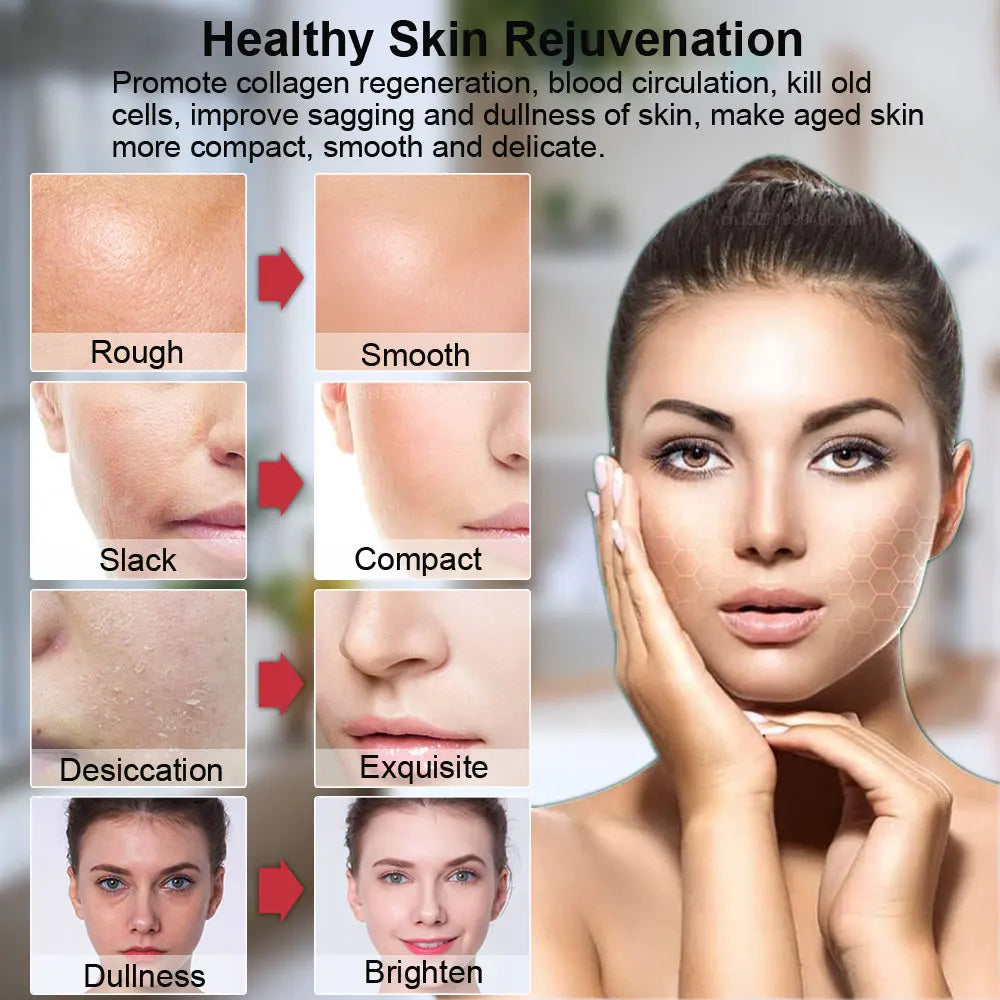 CowLost | hifu-face-lifting-facial-massager-mini-hifu-face-lifting-machine-facial-microcurrent-skin-rejuvenation-anti-aging-face-massager |11