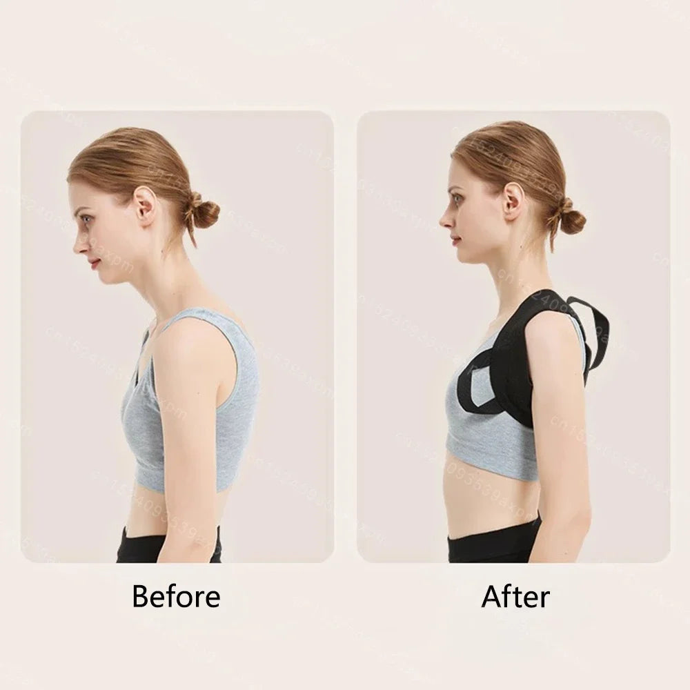 CowLost | back-brace-posture-corrector-for-women-and-men |4