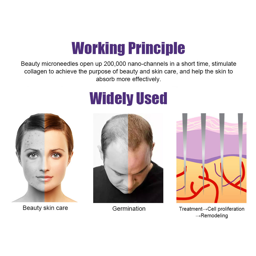 CowLost | vehicle-parts-accessories-suolaer-derma-microneedling-face-roller-for-hair-growth-and-skin-care |8