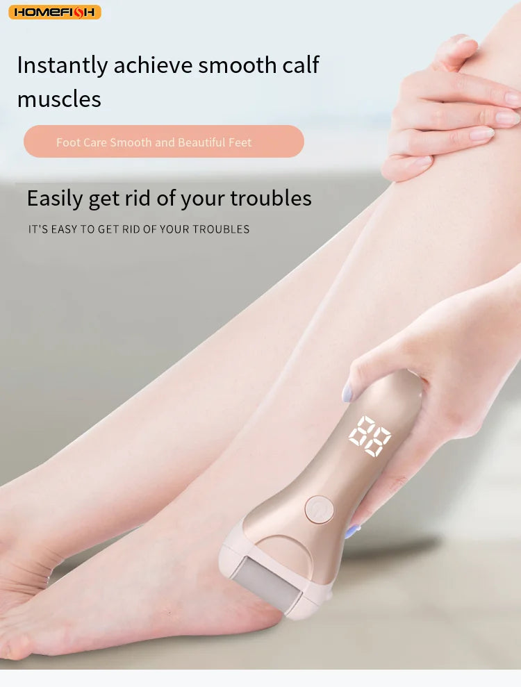 CowLost | product_id-homefish-usb-rechargeable-electric-pedicure-foot-grinder-with-replacement-heads-for-callus-removal |9