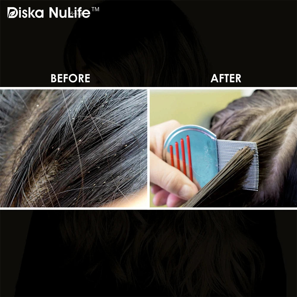 CowLost | tools-stainless-steel-flea-and-lice-comb-for-dogs-cats-and-adults |12
