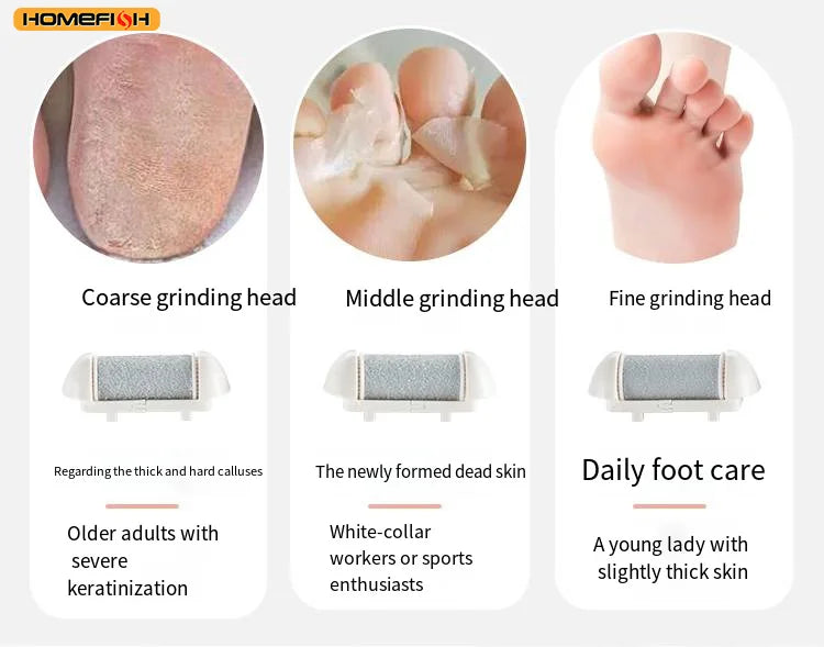 CowLost | product_id-homefish-usb-rechargeable-electric-pedicure-foot-grinder-with-replacement-heads-for-callus-removal |11