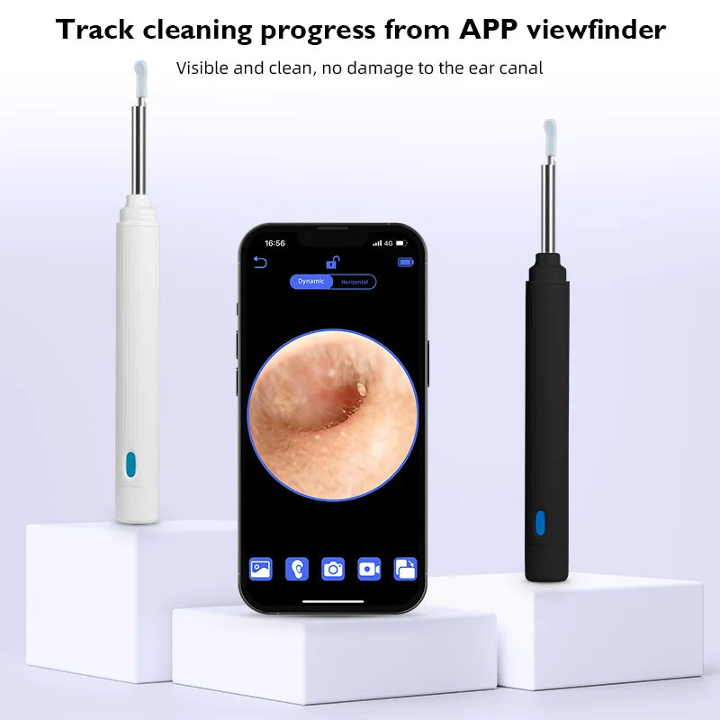 CowLost | 3d-printer-accessories-kerui-5mp-wireless-visual-ear-otoscope-endoscope-earwax-removal-tool |3