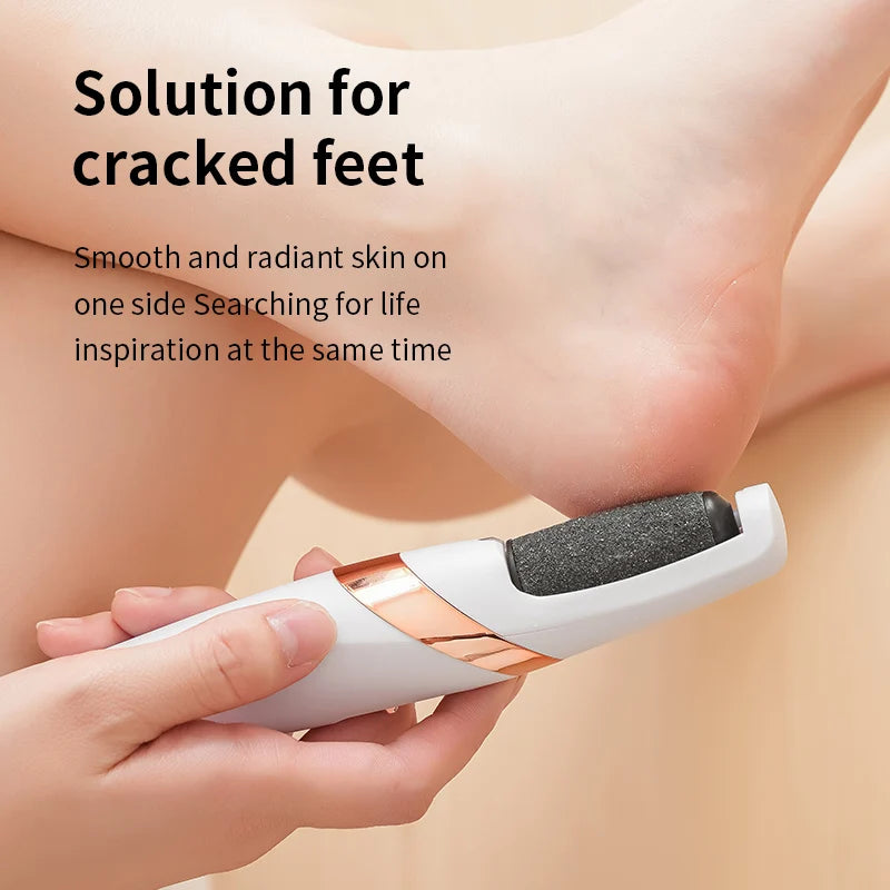 CowLost | product_id-homefish-electric-foot-callus-remover-and-pedicure-grinder |2