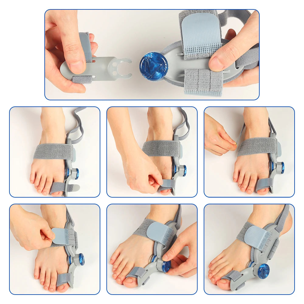 CowLost | bunion-corrector-unisex-valgus-toe-correction-pain-relief-foot-treatment |13