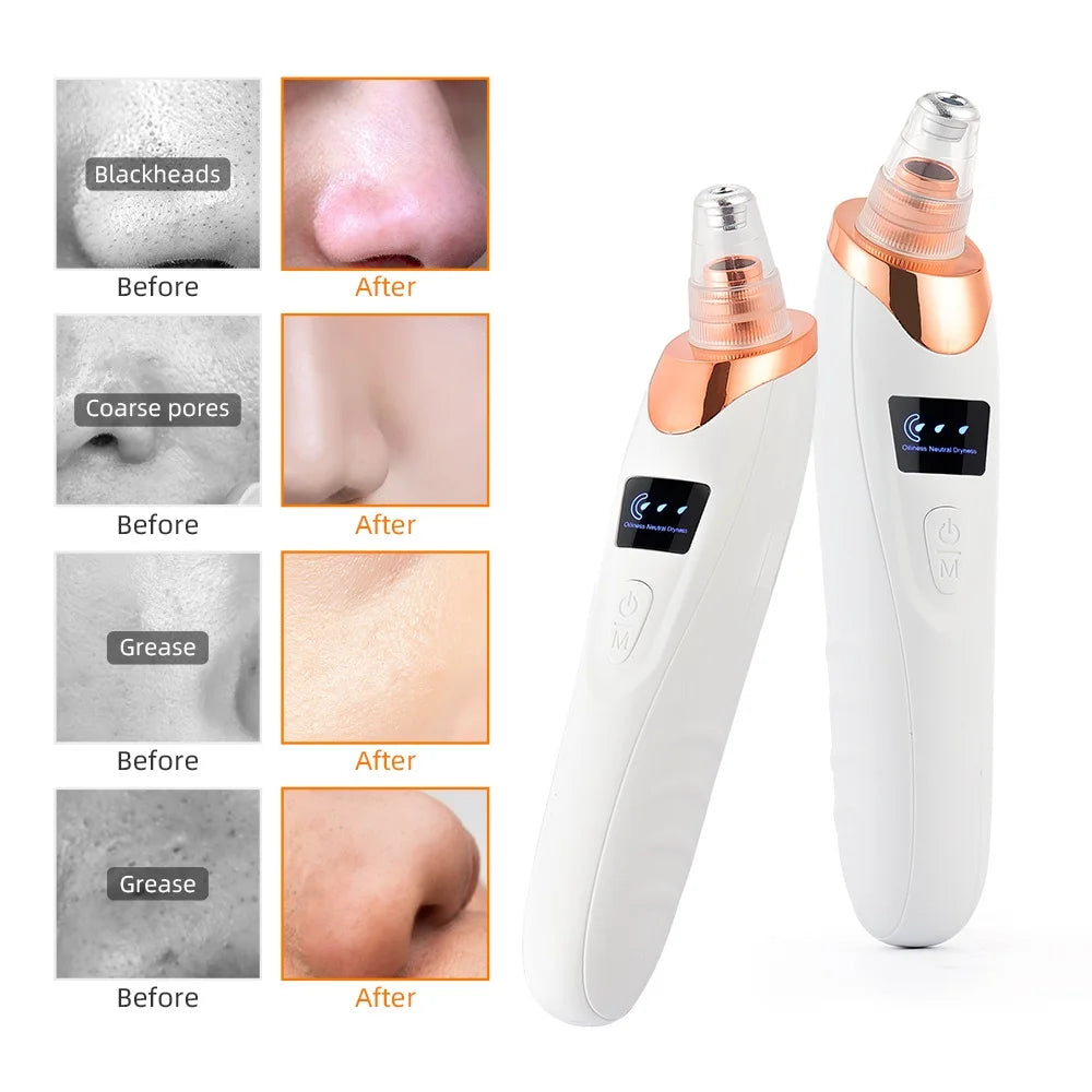 CowLost | nose-blackhead-remover |13