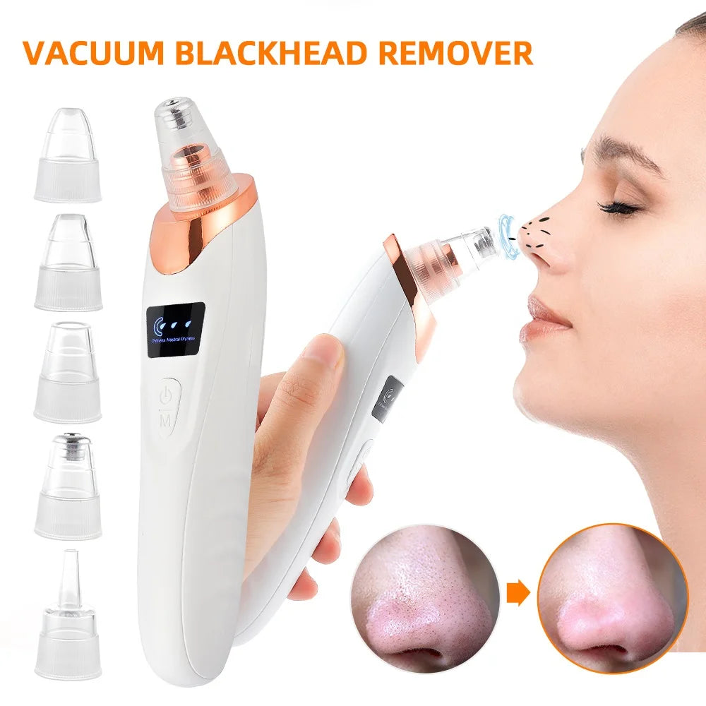 CowLost | nose-blackhead-remover |1