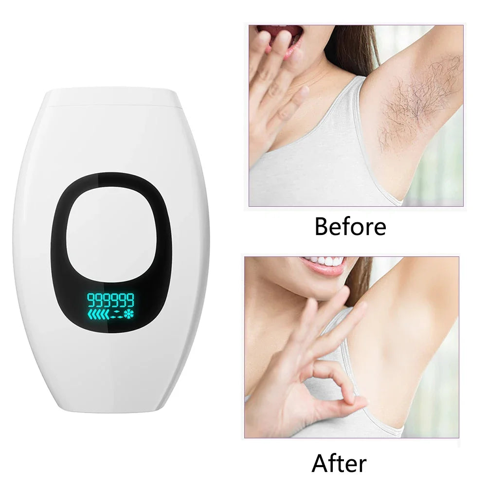 CowLost | product_id-ipl-laser-hair-removal-epilator-999-999-flashes-with-lcd-for-bikini-face |2
