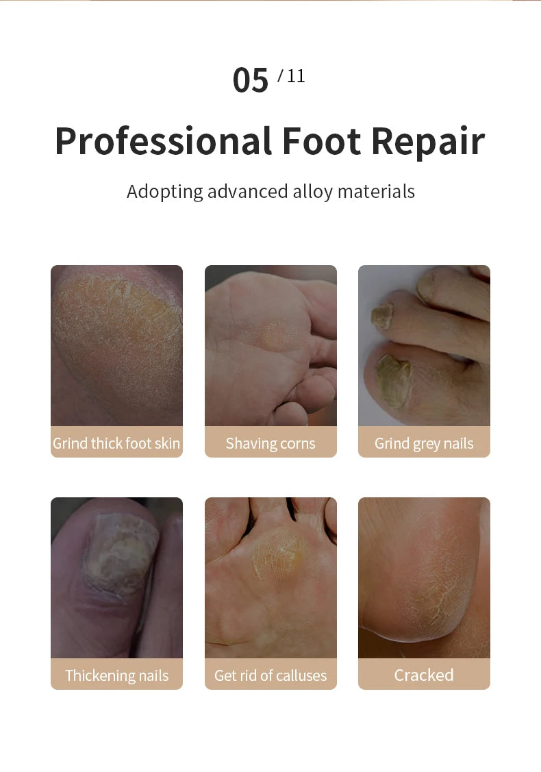 CowLost | product_id-homefish-rechargeable-electric-foot-callus-remover-pedicure-grinder |12