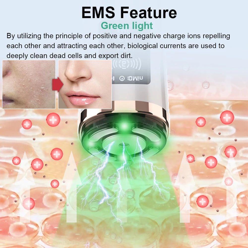 CowLost | hifu-face-lifting-facial-massager-mini-hifu-face-lifting-machine-facial-microcurrent-skin-rejuvenation-anti-aging-face-massager |15