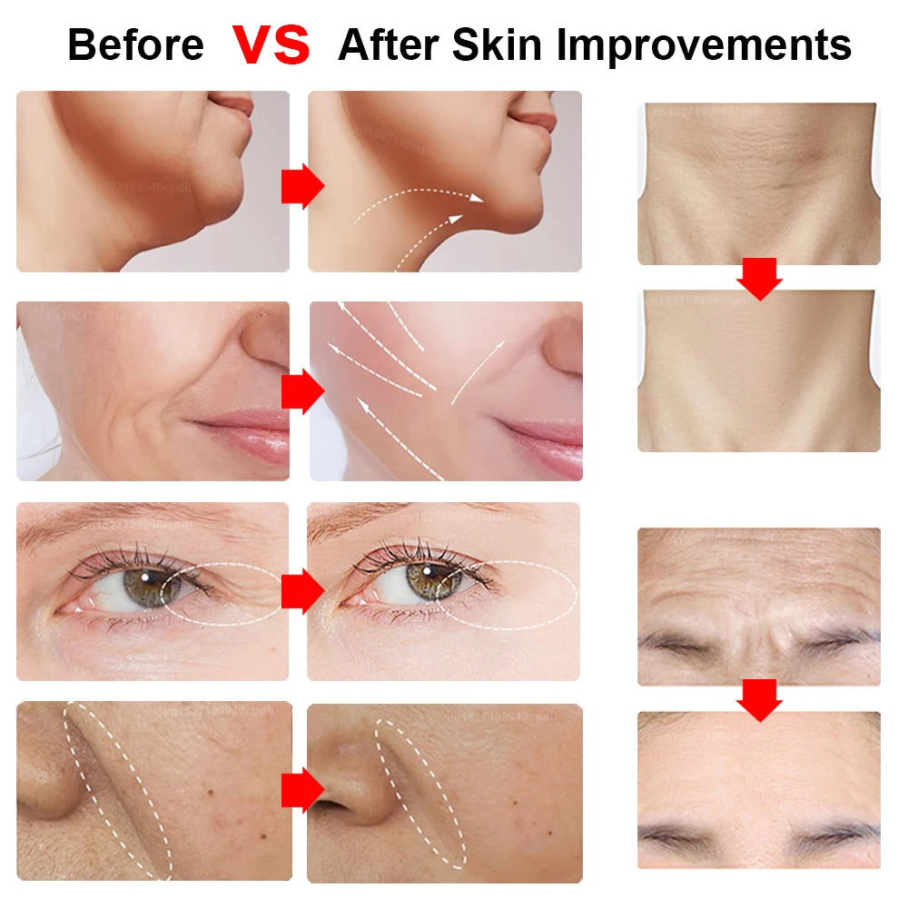 CowLost | hifu-face-lifting-facial-massager-mini-hifu-face-lifting-machine-facial-microcurrent-skin-rejuvenation-anti-aging-face-massager |12